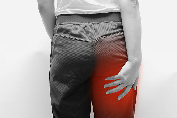 坐骨神経痛のイメージ写真